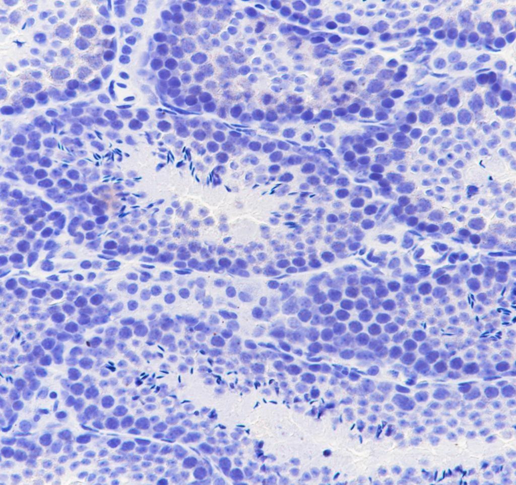 Recombinant MBL2 Monoclonal Antibody - small - 4