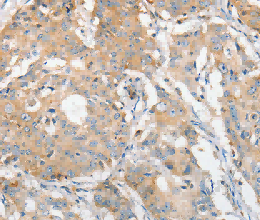 APOBEC3G Polyclonal Antibody - 3