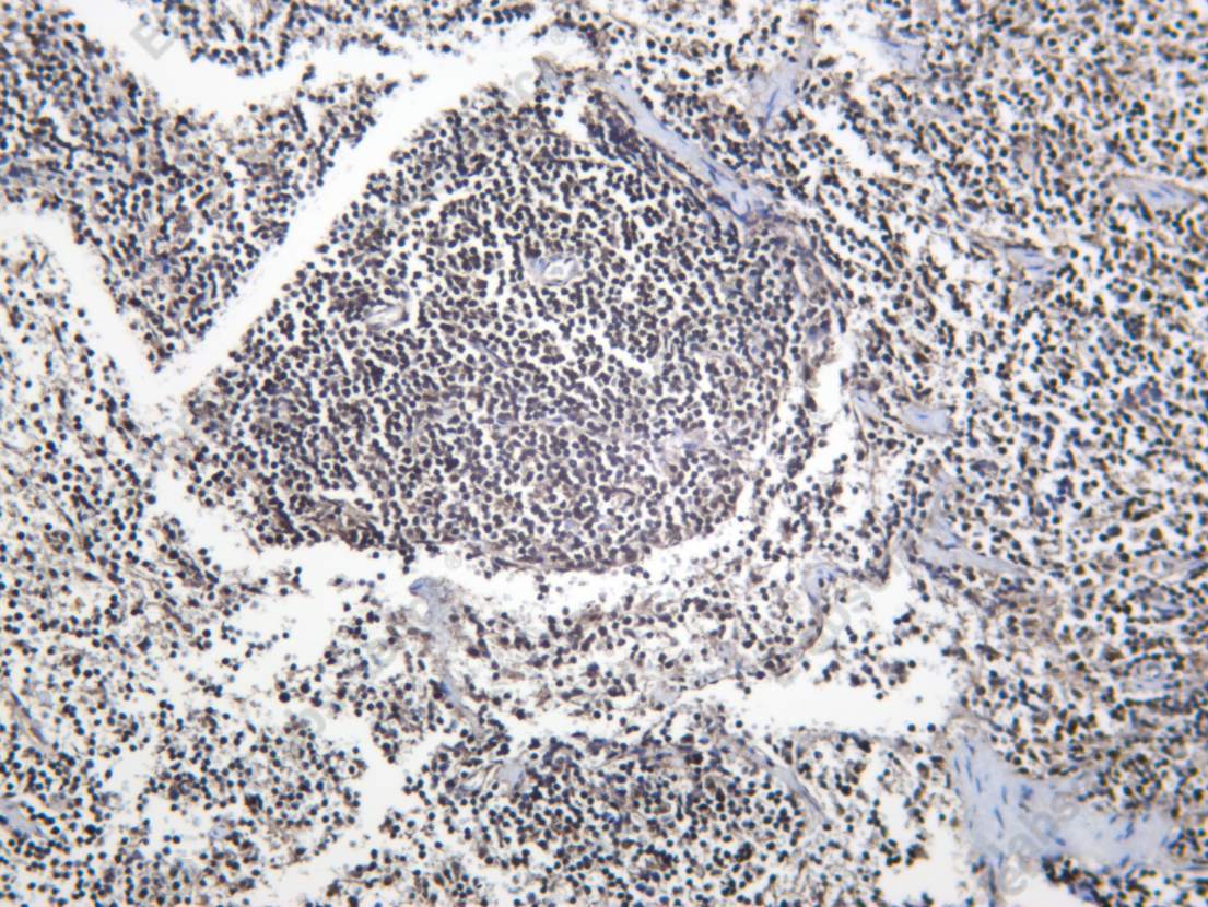 Recombinant PSMB9 Monoclonal Antibody - 3