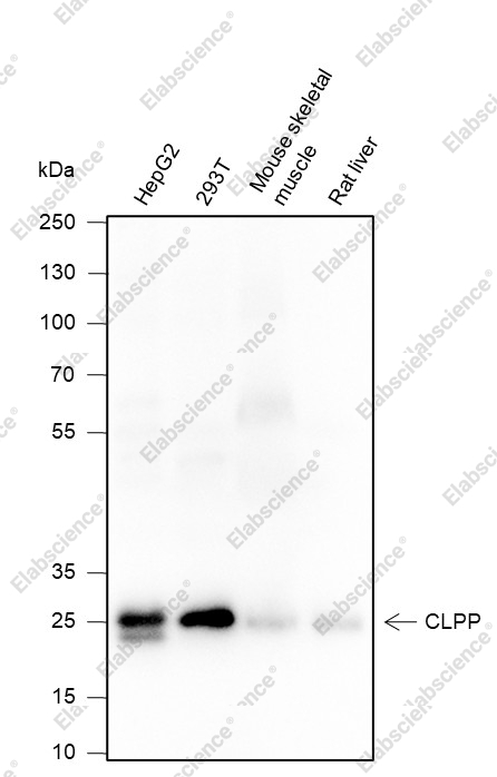 Recombinant CLPP Monoclonal Antibody - 1
