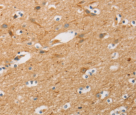 Immunohistochemistry of paraffin-embedded Human brain  tissue using ATG4D Polyclonal Antibody at dilution 1:40