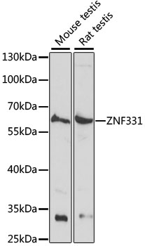 Western blot analysis of extracts of various cell lines using ZNF331 Polyclonal Antibody at dilution of 1:1000.