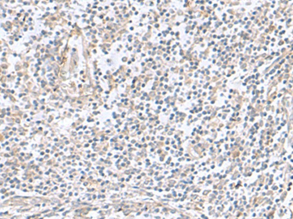 Immunohistochemistry of paraffin-embedded Human tonsil tissue  using TNNC2 Polyclonal Antibody at dilution of 1:50(?200)