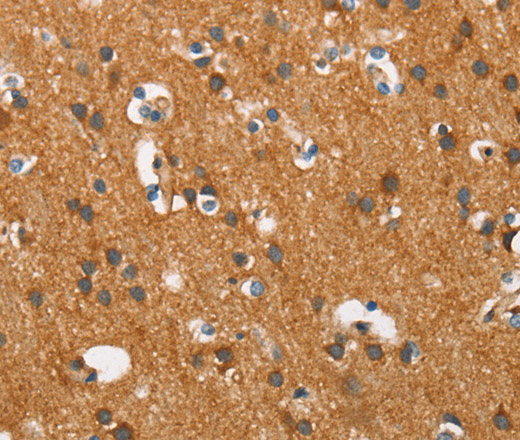 Immunohistochemistry of paraffin-embedded Human brain tissue using COX5A Polyclonal Antibody at dilution 1:40