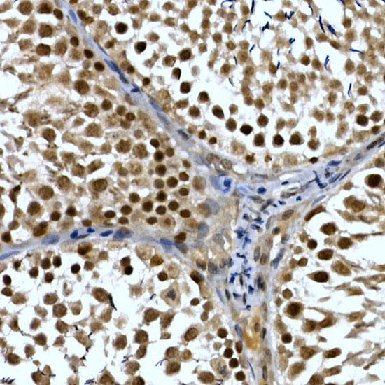 Immunohistochemistry of paraffin-embedded rat testis using NELFCD Polyclonal Antibody at dilution of 1:50 (40x lens).Perform high pressure antigen retrieval with 10 mM citrate buffer pH 6.0 before commencing with IHC staining protocol.