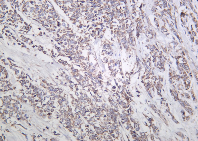 Recombinant Actinin-α1 Monoclonal Antibody-searchlist-1