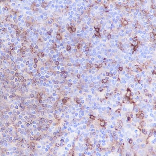 Recombinant HLA-DPA1 Monoclonal Antibody - 3