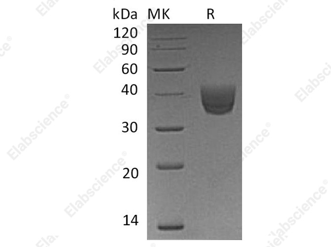 Recombinant Human CD157/BST1 Protein (His Tag) - 1