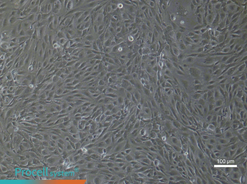 Human Pulmonary Microvascular Endothelial (Primary cell immortalization) Cell Complete MediumHuman Pulmonary Microvascular Endothelial (Primary cell immortalization) Cell Complete Medium - 2