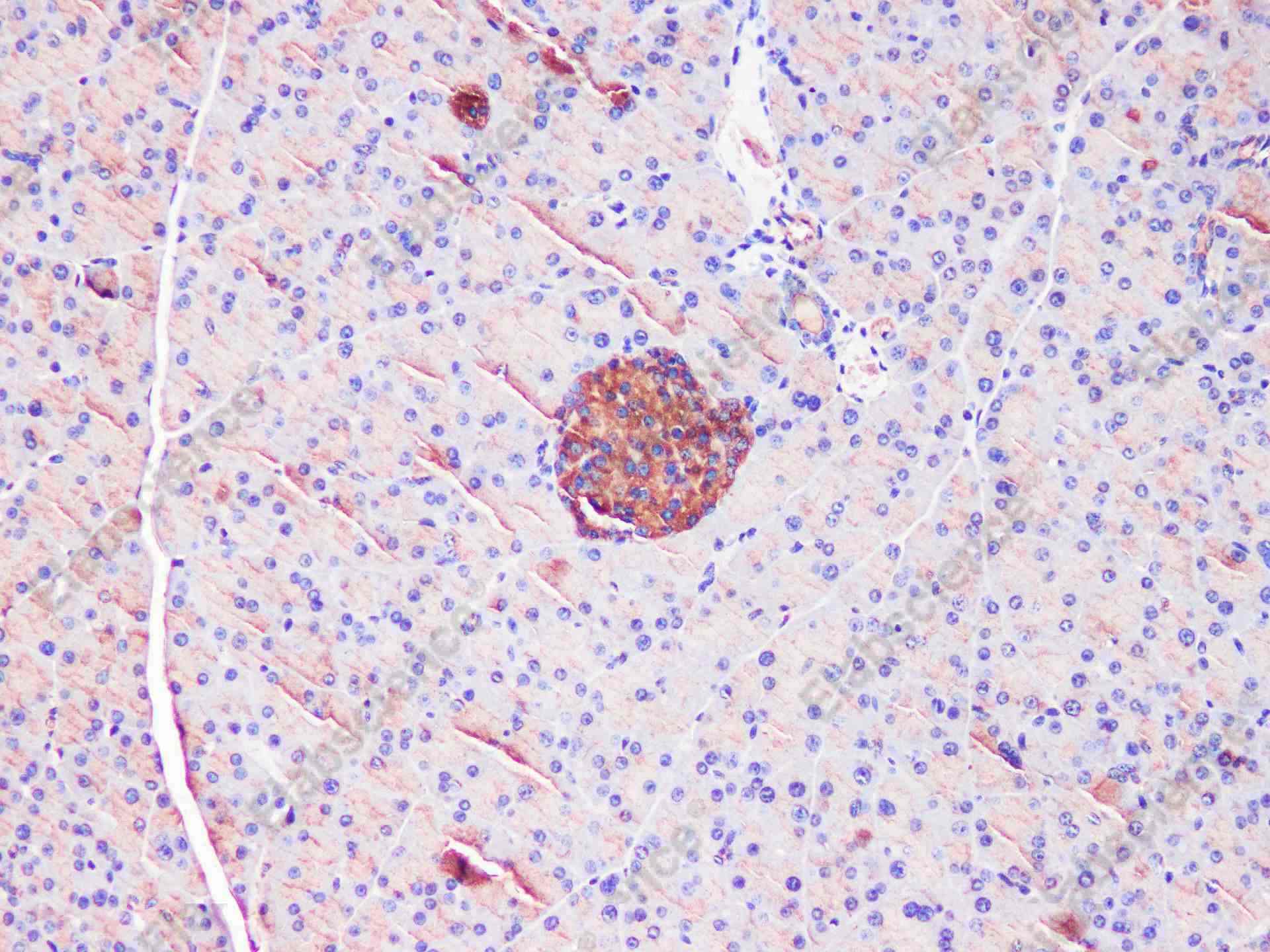 EEF2 Polyclonal Antibody - 4