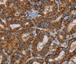 MRPL28 Polyclonal Antibody - 2