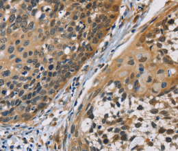 CBR1 Polyclonal Antibody - 2