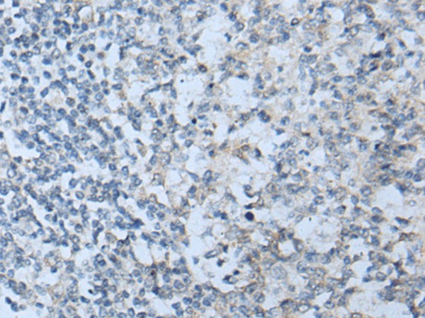 Immunohistochemistry of paraffin-embedded Human tonsil tissue  using STARD4 Polyclonal Antibody at dilution of 1:50(?200)