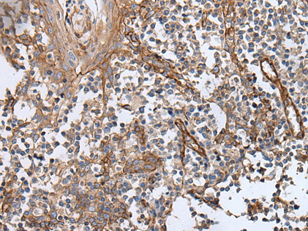 Immunohistochemistry of paraffin-embedded Human tonsil tissue  using BLVRB Polyclonal Antibody at dilution of 1:65(?200)