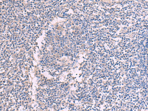 Immunohistochemistry of paraffin-embedded Human tonsil tissue  using CCT5 Polyclonal Antibody at dilution of 1:60(?200)