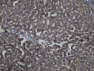 Recombinant WEE1 Monoclonal Antibody - 2