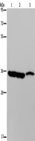 Western Blot analysis of Mouse heart, liver and stomach tissue using MDH1 Polyclonal Antibody at dilution of 1:500