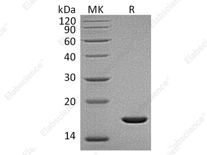 Recombinant Human FGF-2/FGFb Protein (aa 132-288) - 1