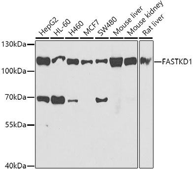 Western blot analysis of extracts of various cell lines using FASTKD1 Polyclonal Antibody at 1:1000 dilution.