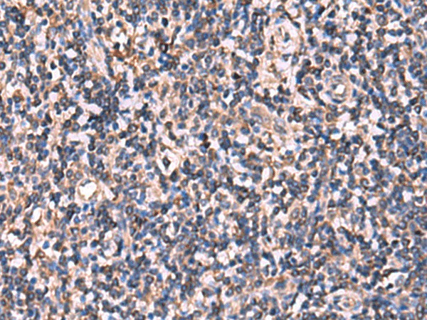 Immunohistochemistry of paraffin-embedded Human tonsil tissue  using RHAG Polyclonal Antibody at dilution of 1:110(?200)