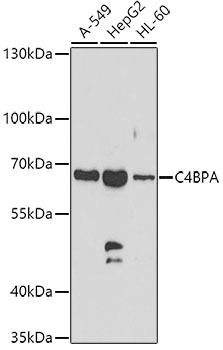 Western blot analysis of extracts of various cell lines using C4BPA Polyclonal Antibody at dilution of 1:1000.