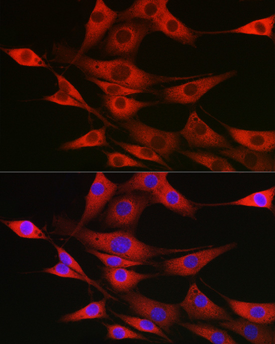 Immunofluorescence analysis of NIH/3T3 cells using SSR2 Polyclonal Antibody at dilution of 1:100 (40x lens). Blue: DAPI for nuclear staining.