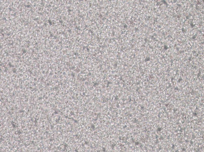 SU-DHL-1 Cell Complete Medium - 3