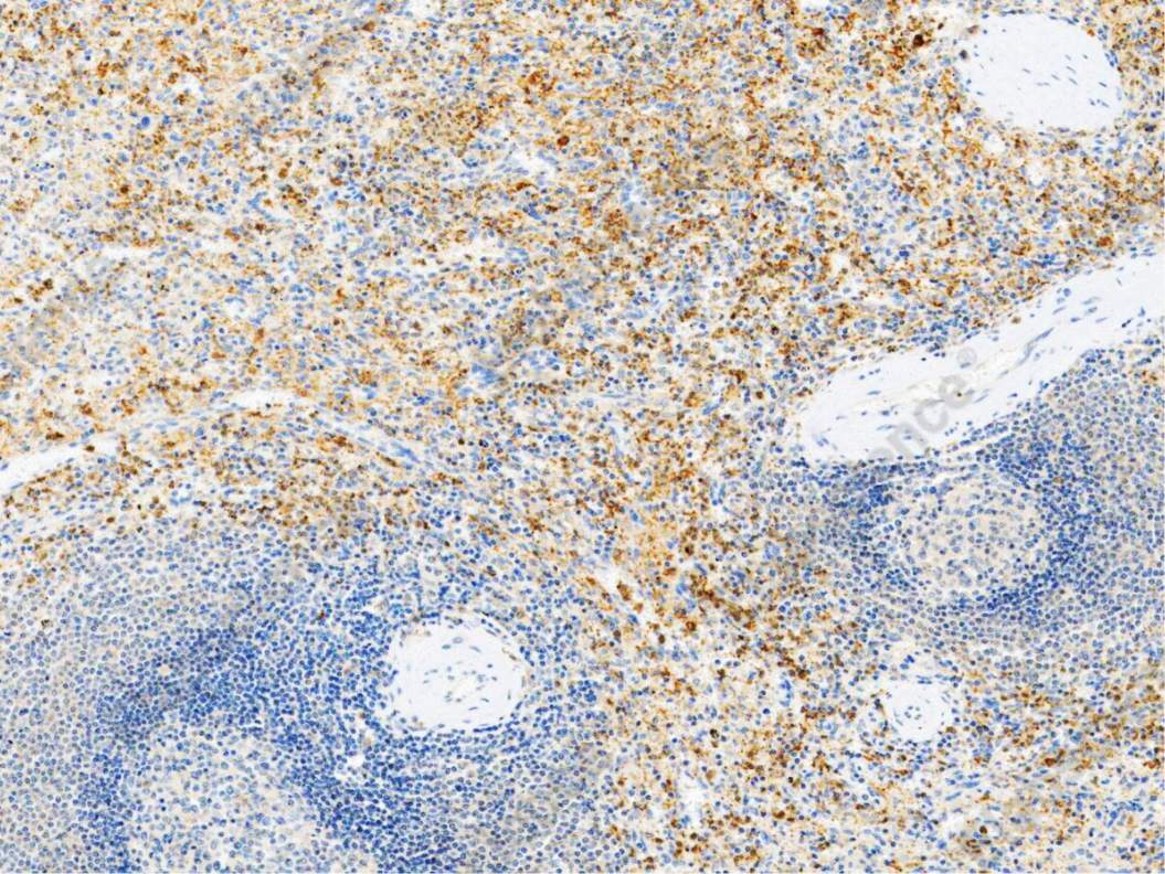 Recombinant IFNAR1 Monoclonal Antibody - 1
