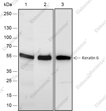 Recombinant Keratin 6 Monoclonal Antibody - 1
