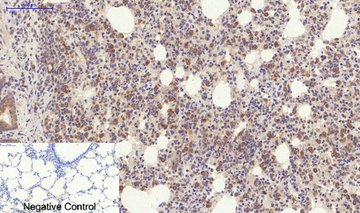 Immunohistochemistry of paraffin-embedded Rat lung tissue using YAP1 Polyclonal Antibody at dilution of 1:200.