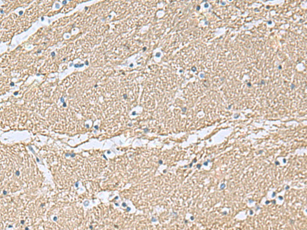 Immunohistochemistry of paraffin-embedded Human brain tissue  using TAGLN3 Polyclonal Antibody at dilution of 1:70(?200)