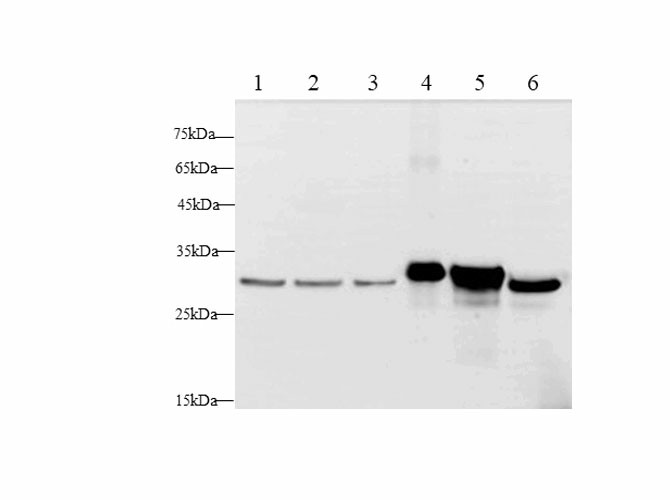 Western blot with Lgals3 Polyclonal antibody at dilution of 1:500.lane 1:Hela whole cell lysate, lane 2:MCF-7 whole cell lysate, lane 3:A431 whole cell lysate, lane 4:RAW264.7 whole cell lysate, lane 5:NIH/3T3 whole cell lysate, lane 6:C6 whole cell lysate