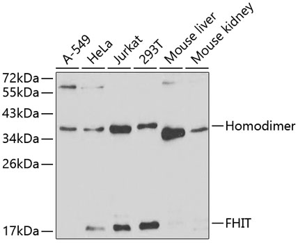 Western blot analysis of extracts of various cell lines using FHIT Polyclonal Antibody at 1:1000 dilution.