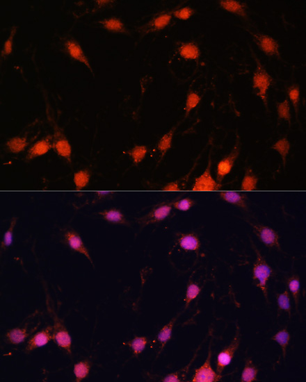 Immunofluorescence analysis of C6 cells using ZNF416 Polyclonal Antibody at dilution of  1:100. Blue: DAPI for nuclear staining.