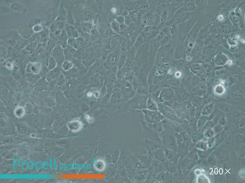 WI-38 VA-13 subline 2RA Cell Complete Medium - 6