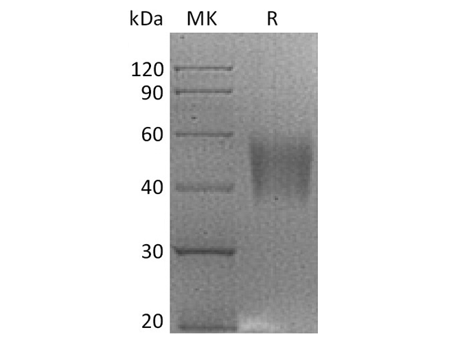 Recombinant Rhesus macaque B7-H4/VTCN1 Protein (His Tag)