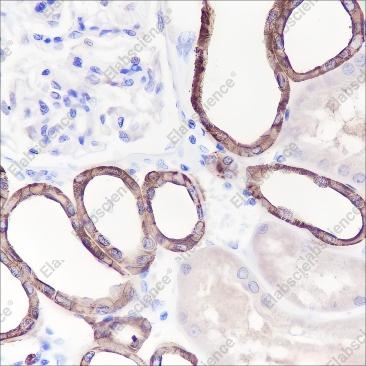 Recombinant TMPRSS2 Monoclonal Antibody - 2