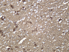 Recombinant Neurofascin Monoclonal Antibody - 2