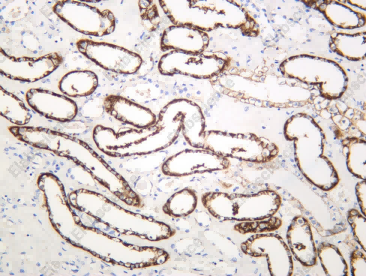 Recombinant KSP-Cadherin Monoclonal Antibody - 1