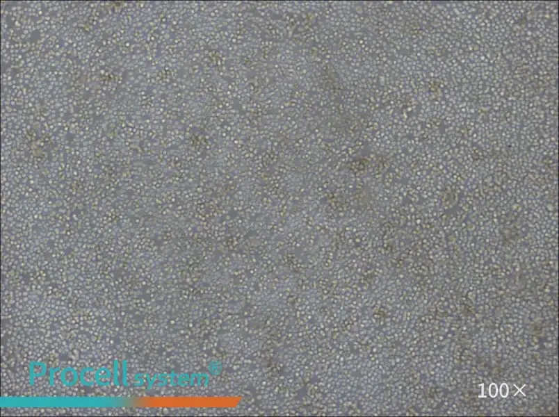 DoHH2 Cell Complete MediumDoHH2 Cell Complete Medium - 2