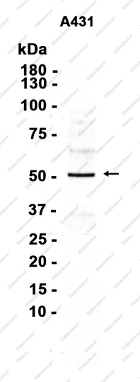 Recombinant Keratin 16 Monoclonal Antibody - 1