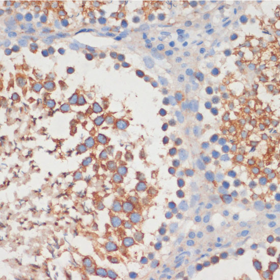 Immunohistochemistry of paraffin-embedded Rat testis using CDC42 Polyclonal Antibody at dilution of  1:100 (40x lens).