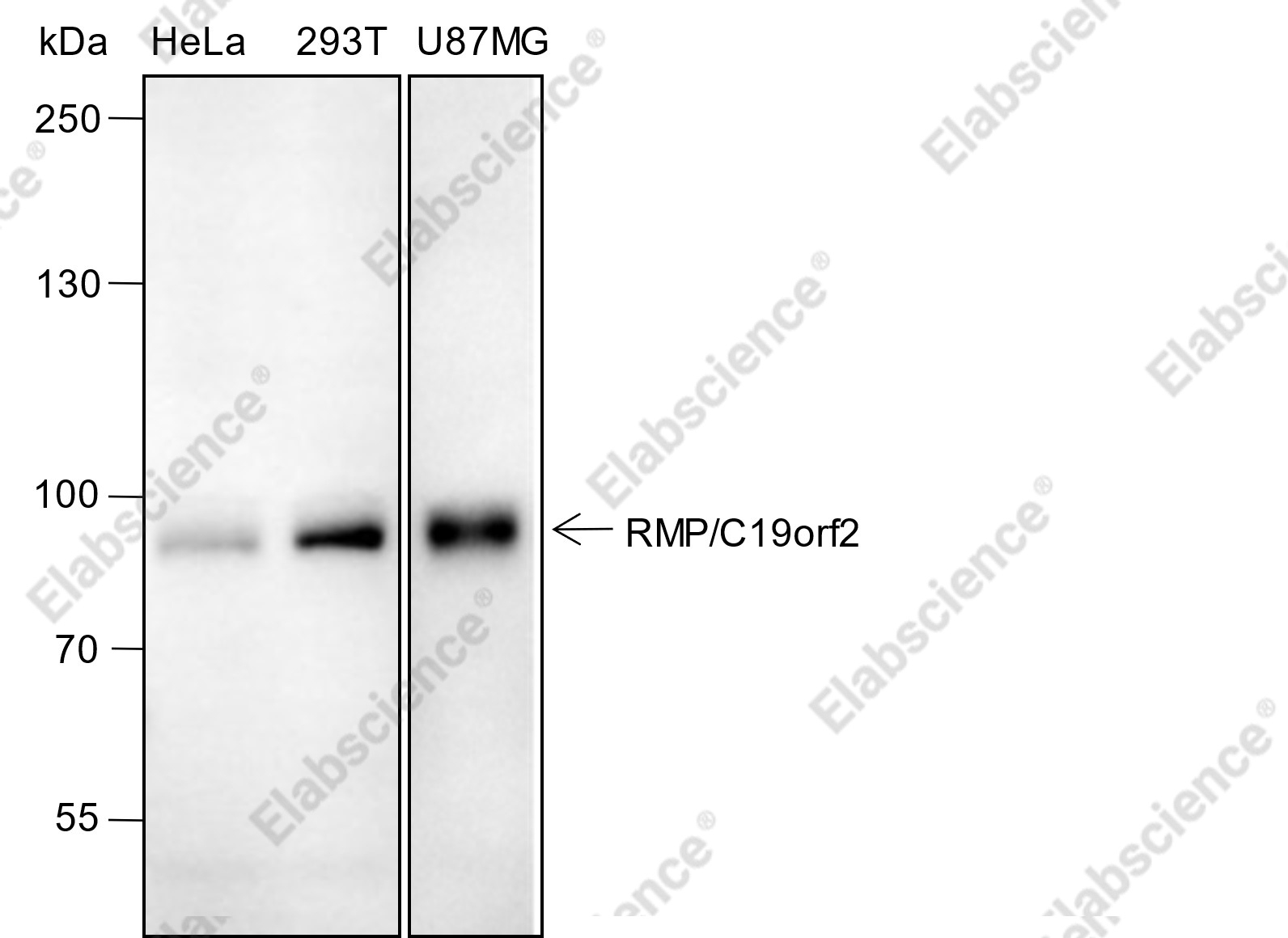 Recombinant RMP/C19orf2 Monoclonal Antibody - 1
