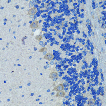 Immunohistochemistry of paraffin-embedded Mouse brain using Nestin Polyclonal Antibody at dilution of  1:100 (40x lens).