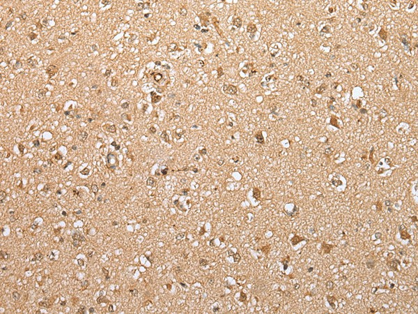 Immunohistochemistry of paraffin-embedded Human brain tissue  using ATXN7L3 Polyclonal Antibody at dilution of 1:35(?200)