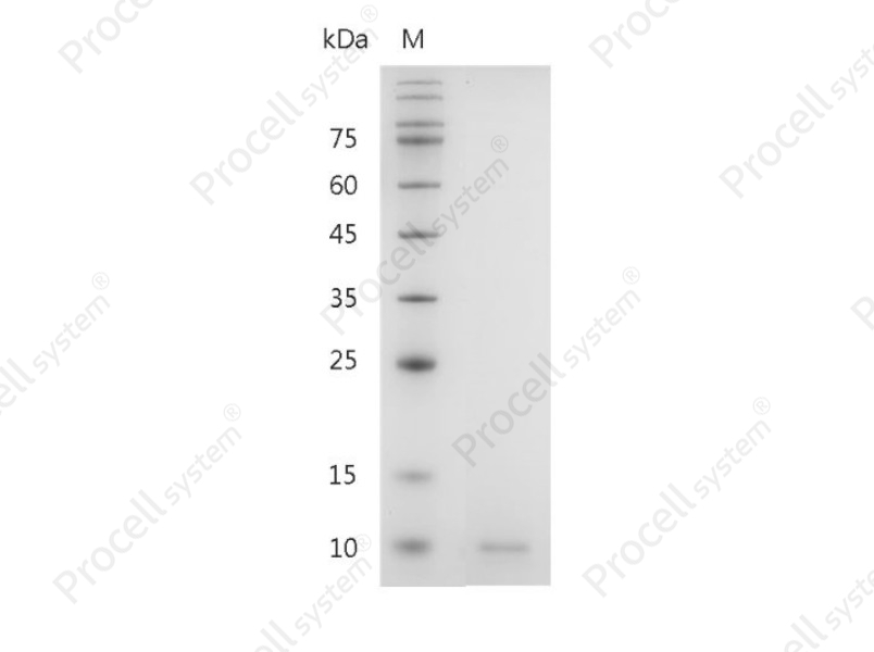 CXCL5/ENA-78, Human, Recombinant