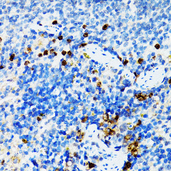 Immunohistochemistry of paraffin-embedded Mouse spleen using STAT3 Polyclonal Antibody at dilution of 1:100 (40x lens).