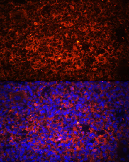 Immunofluorescence analysis of Rat spleen using TLR8 Polyclonal Antibody at dilution of  1:100 (40x lens). Blue: DAPI for nuclear staining.