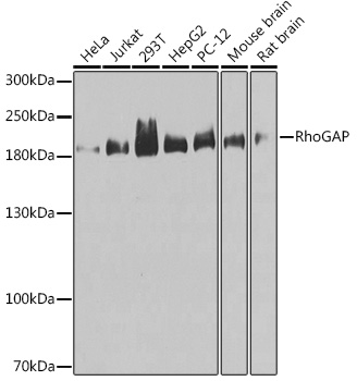 Western blot analysis of extracts of various cell lines using RhoGAP Polyclonal Antibody at 1:1000 dilution.