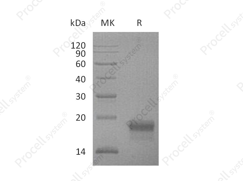 VEGF-D/FIGF (C-6His), Mouse, Recombinant